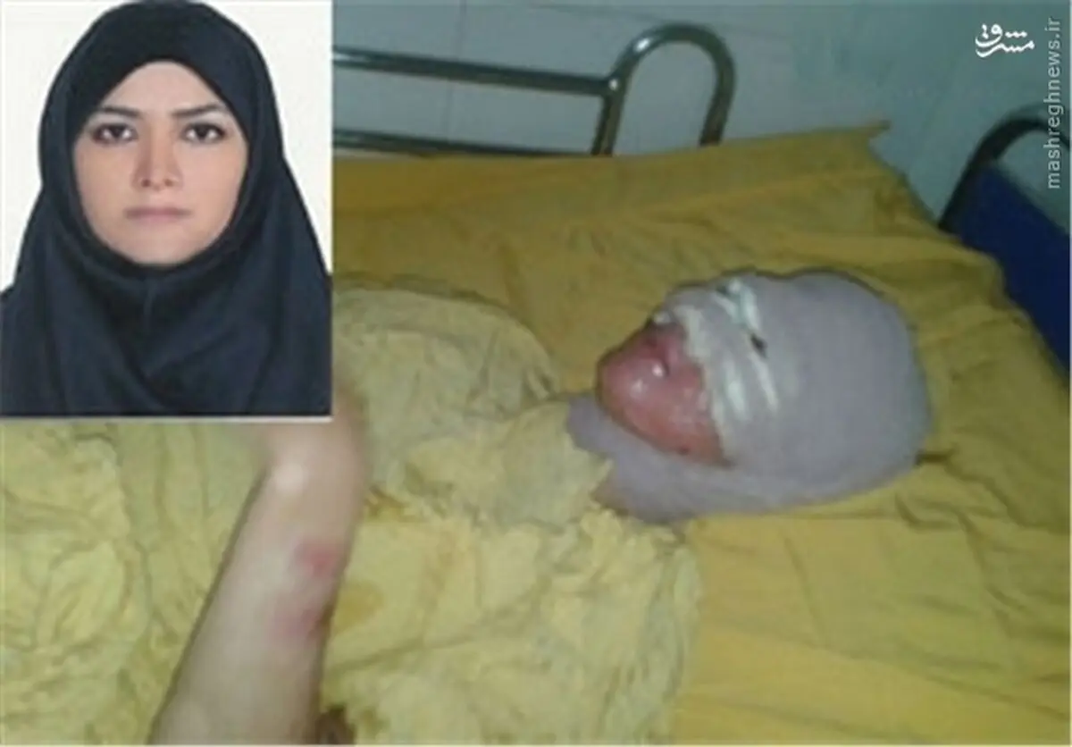 جزای پدری که روی دخترش اسید پاشید+عکس