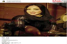 پوشش متفاوت بازیگر نقش پرستار شیرین در مجموعه شهرزاد/ عکس