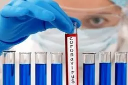 آخرین خبر از سرایت کرونا حیوان به انسان !