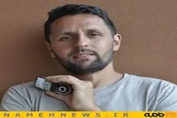 مردی که دست راستش را سوژه کرد!+تصاویر