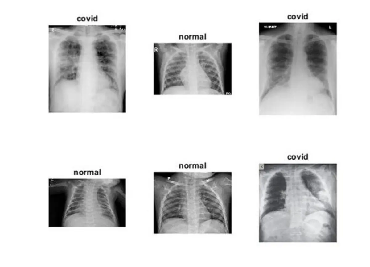 تشخیص "کروناویروس" با هوش مصنوعی با دقت ۹۸ درصد و ظرف چند ثانیه