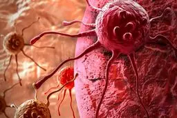 درمان جدید سرطان ریه کشف شد