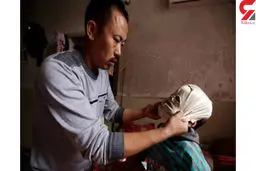 پسربچه‌ ای که چهره ندارد + عکس زندگی دردناک