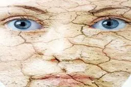 7 عادت روزمره که پوست شما را خشک می کند