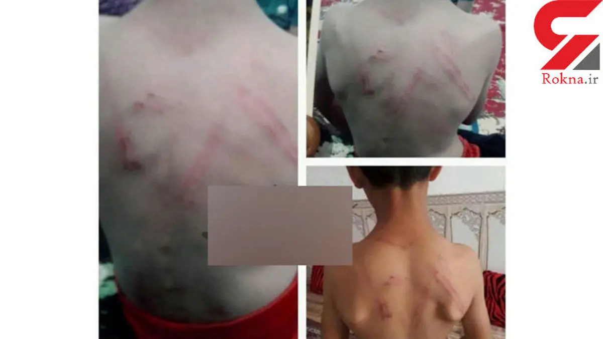 تصاویر دردناک از شکنجه هولناک یک کودک توسط معلم خوزستانی