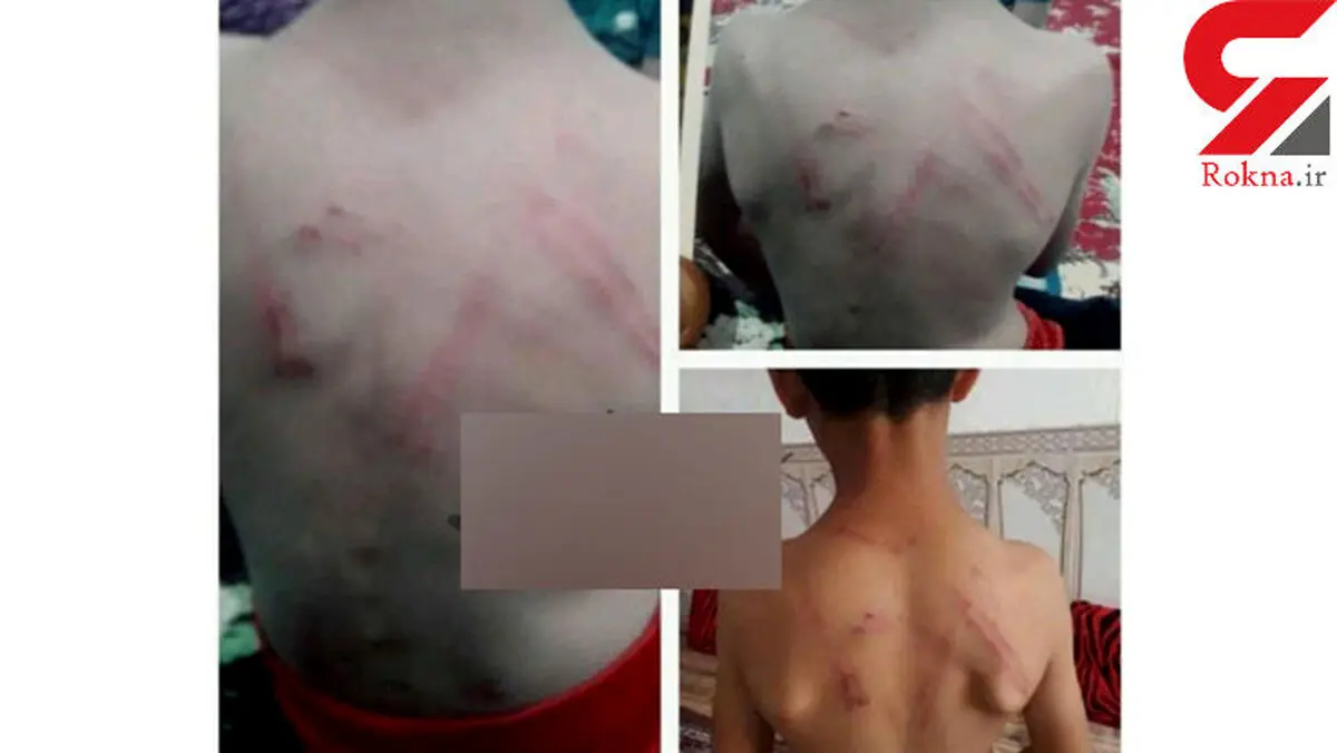 تصاویر دردناک از شکنجه هولناک یک کودک توسط معلم خوزستانی