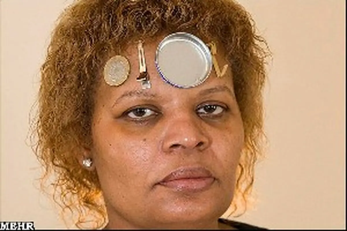 زنی که فلزات را جذب می‌کند/عکس