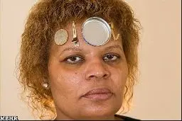 زنی که فلزات را جذب می‌کند/عکس