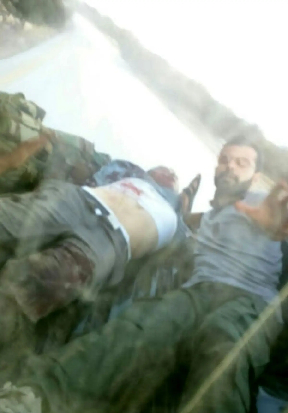 لحظه مجروحیت خبرنگار ایرانی/عکس