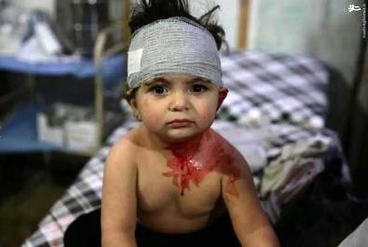 تصاویر دلخراش از یک بیمارستان صحرایی در سوریه