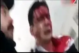 ببینید: روایت تنها بازمانده حادثه سقوط هواپیمای ارتش از معجزه زنده ماندش: شاید کاری در این دنیا مانده که باید انجام دهم
