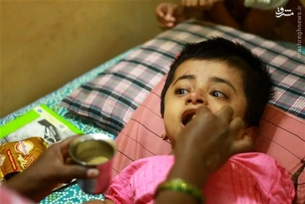 عکس/ دختر 19ساله در بدن کودک دوساله