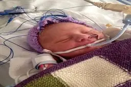 نوزادی که مُرد و زنده شد/ عکس