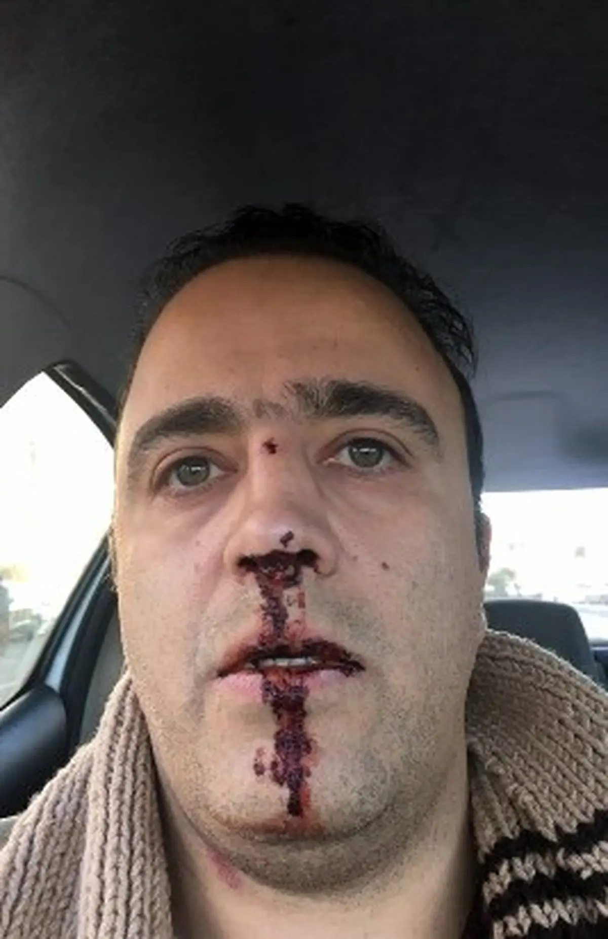 کتک کاری در باشگاه استقلال به دنبال افشاگری های اکبرپور/ واکنش باشگاه: به ما مربوط نیست! + عکس