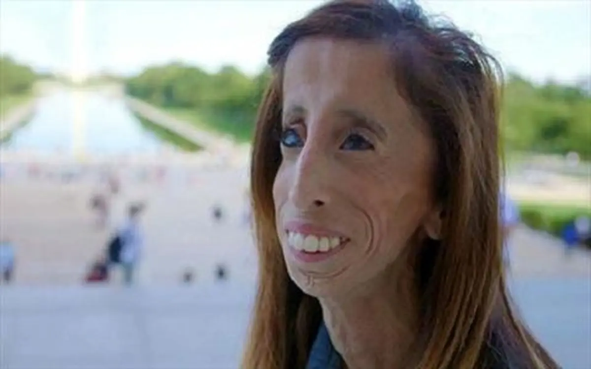 زشت ترین زن دنیا؛ قهرمان فیلم مستند! + عکس