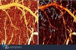 کوکائین با مغز چه می کند؟+عکس