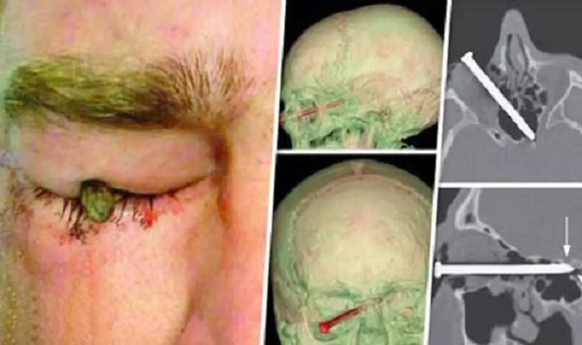 تصویر معجزه باورنکردنی برای یک باغبان