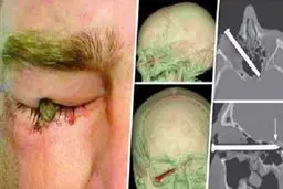 تصویر معجزه باورنکردنی برای یک باغبان