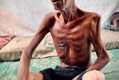 گرسنگی موذن