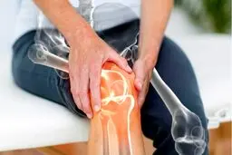نسخه خانگی برای تسکین درد آرتروز زانو

