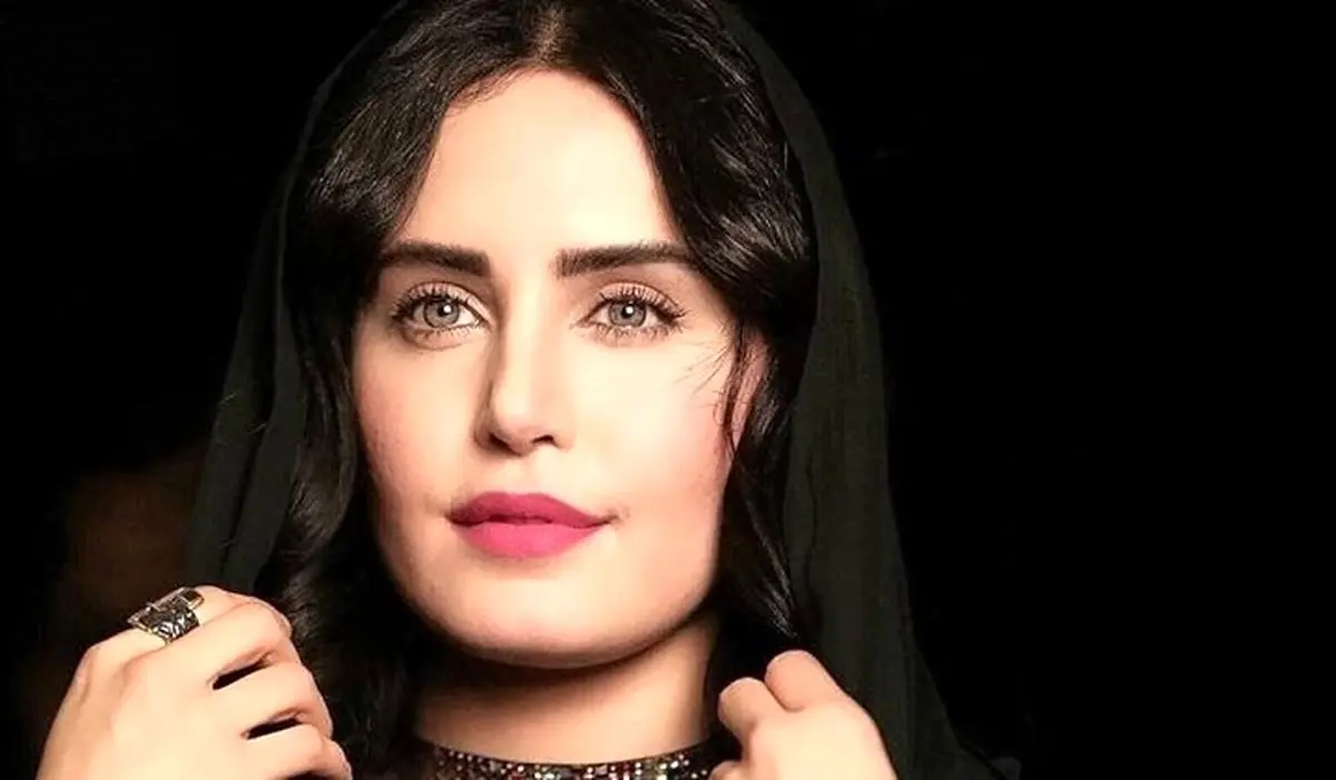 الناز شاکر دوست با چهره زخمی 