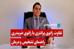 تفاوت زانوی پرانتزی با زانوی ضربدری - راهنمای تشخیص و درمان

