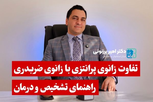 تفاوت زانوی پرانتزی با زانوی ضربدری - راهنمای تشخیص و درمان

