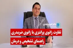 تفاوت زانوی پرانتزی با زانوی ضربدری - راهنمای تشخیص و درمان

