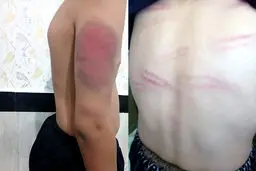 روایت جدید از شکنجه هولناک ۱۳ دانش‌آموز در سنندج