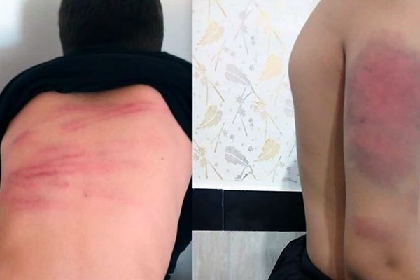 حکم اولیه پرونده شکنجه دانش‌آموزان با کابل صادر شد