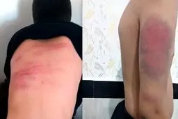 حکم اولیه پرونده شکنجه دانش‌آموزان با کابل صادر شد