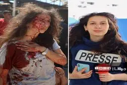 چهره خونین خبرنگار زن فلسطینی بعد از بمباران اسرائیل 