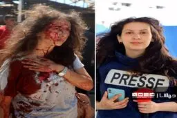 چهره خونین خبرنگار زن فلسطینی بعد از بمباران اسرائیل 