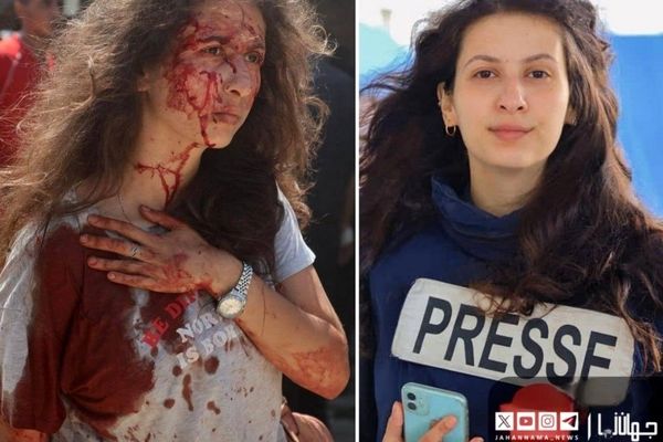 چهره خونین خبرنگار زن فلسطینی بعد از بمباران اسرائیل 