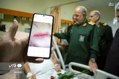 مجروحان حوادث