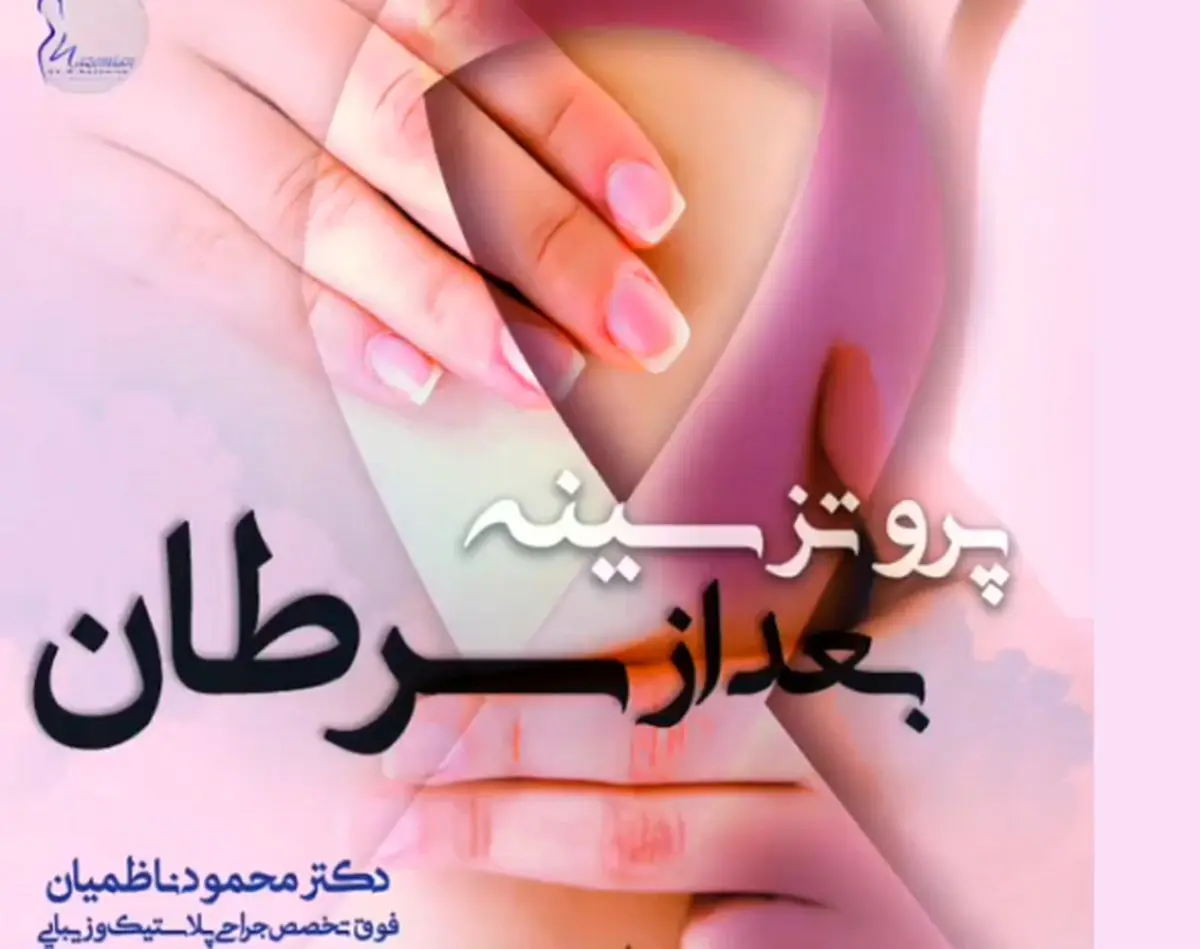 معرفی پروتز بعد از جراحی سرطان سینه