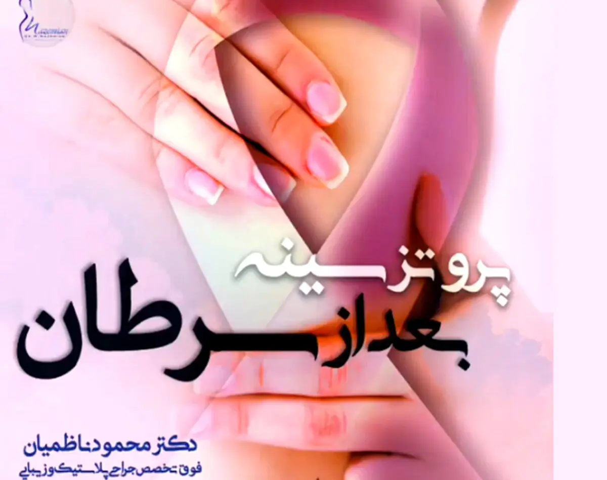 معرفی پروتز بعد از جراحی سرطان سینه