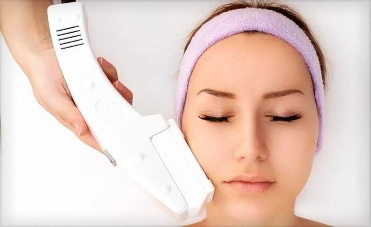 آیا با لیزر موهای زائد برای همیشه از بین میروند؟