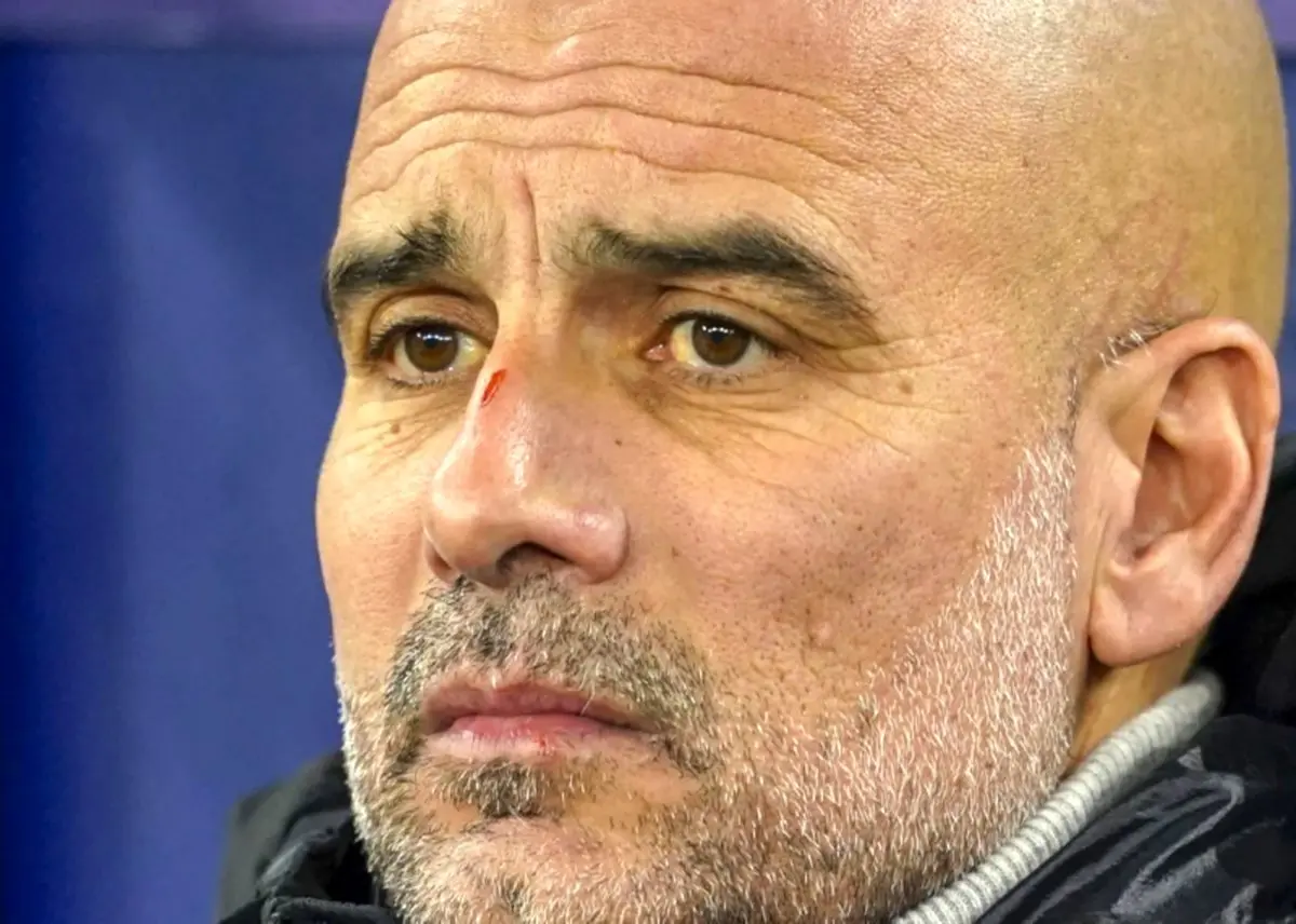 گواردیولا زخمی و مثل  کتک خورده ها مقابل خبرنگاران