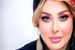 زخم خونین صورت نیوشا ضیغی! / سرش هم باندپیچی است ! + عکس