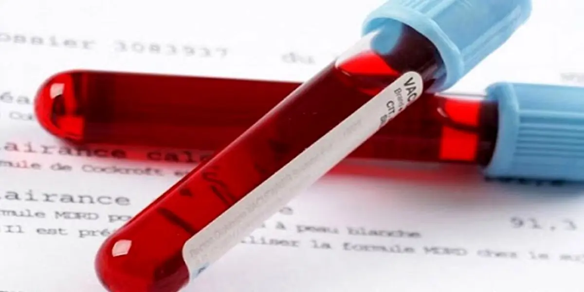 کلسترول بالا چه عوارضی دارد؟