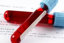 کلسترول بالا چه عوارضی دارد؟