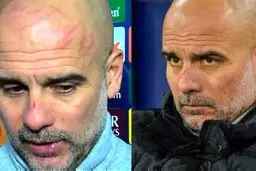 چرا گواردیولا خودش را زخمی می‌کند!