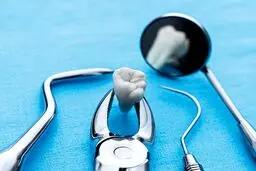 تعرفه خدمات عمومی دندانپزشکی سال 1401 چقدر است؟
