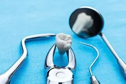 تعرفه خدمات عمومی دندانپزشکی سال 1401 چقدر است؟
