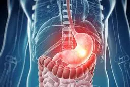 اگر معده شما ترش میکند حتما این مطلب را بخوانید