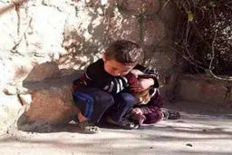 کودکی که سپر بلای خواهرش شد+ عکس