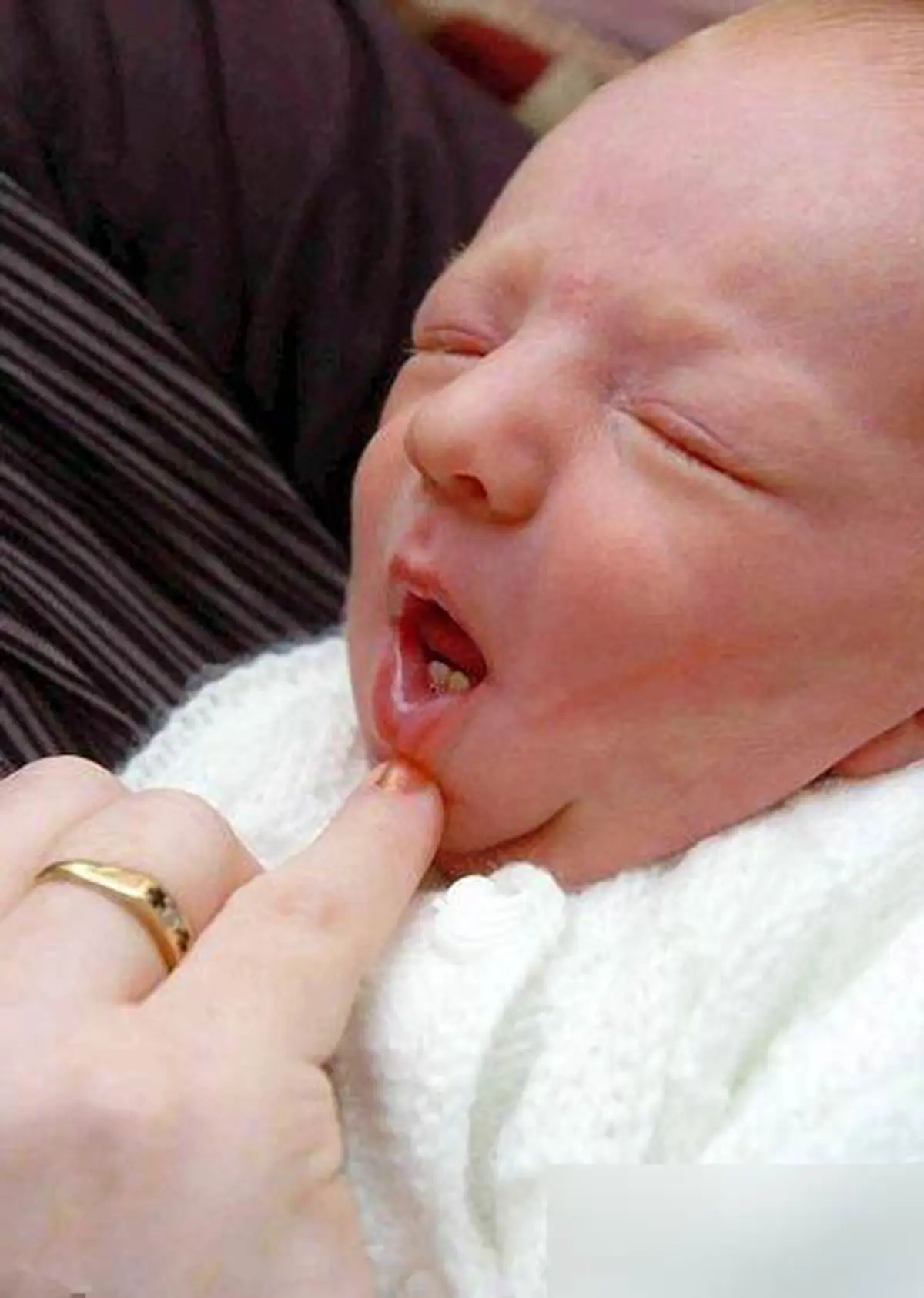 تولد نوزادی با دو دندان/عکس