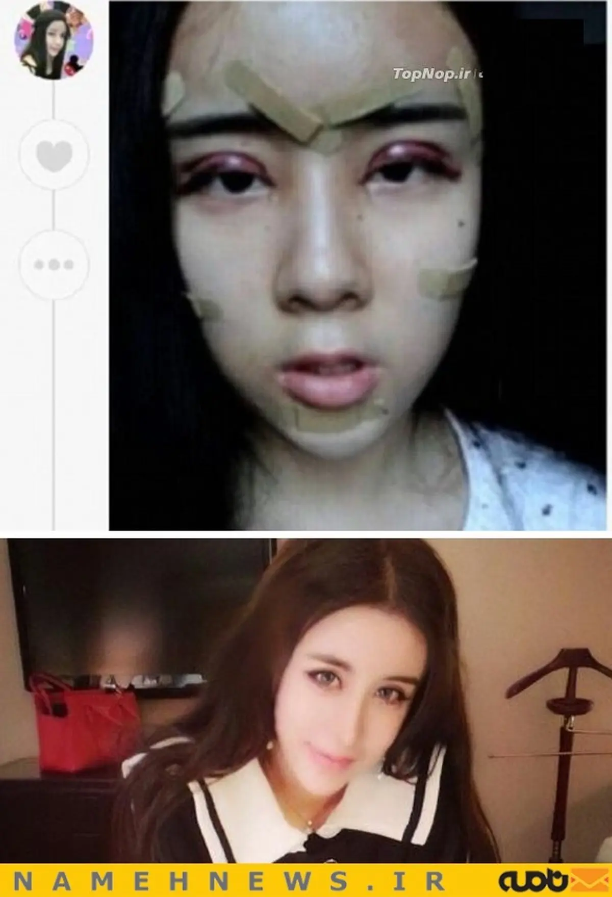 جراحی عروسکی بر روی یک دختر نوجوان+عکس