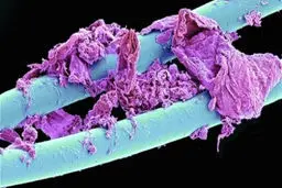 نخ دندان استفاده شده زیر میکروسکوپ / عکس